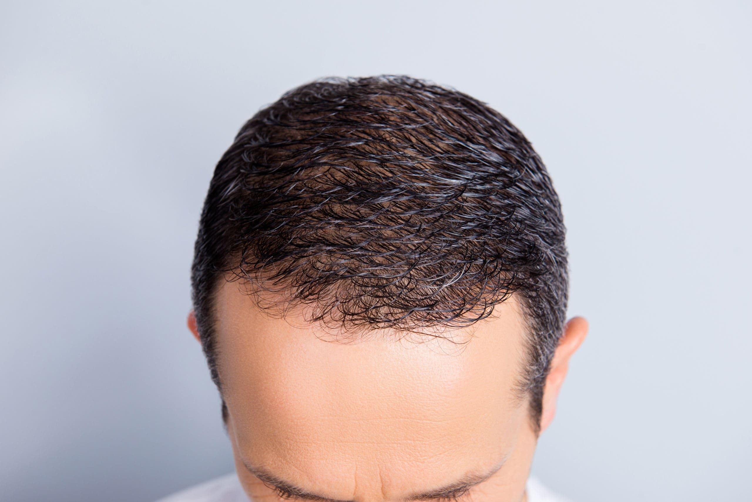 Keravive scalp treatments
