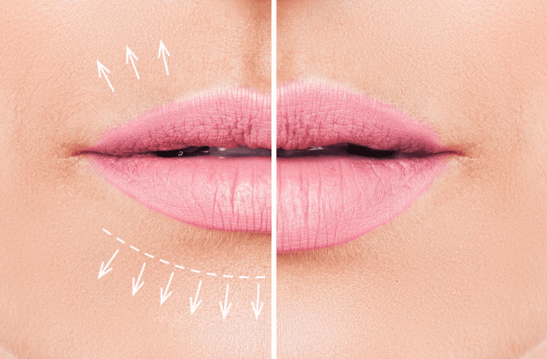 lip enhancements